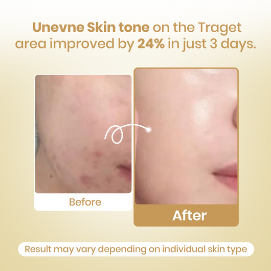 Kojic Acid Turmeric Wrapping Mask